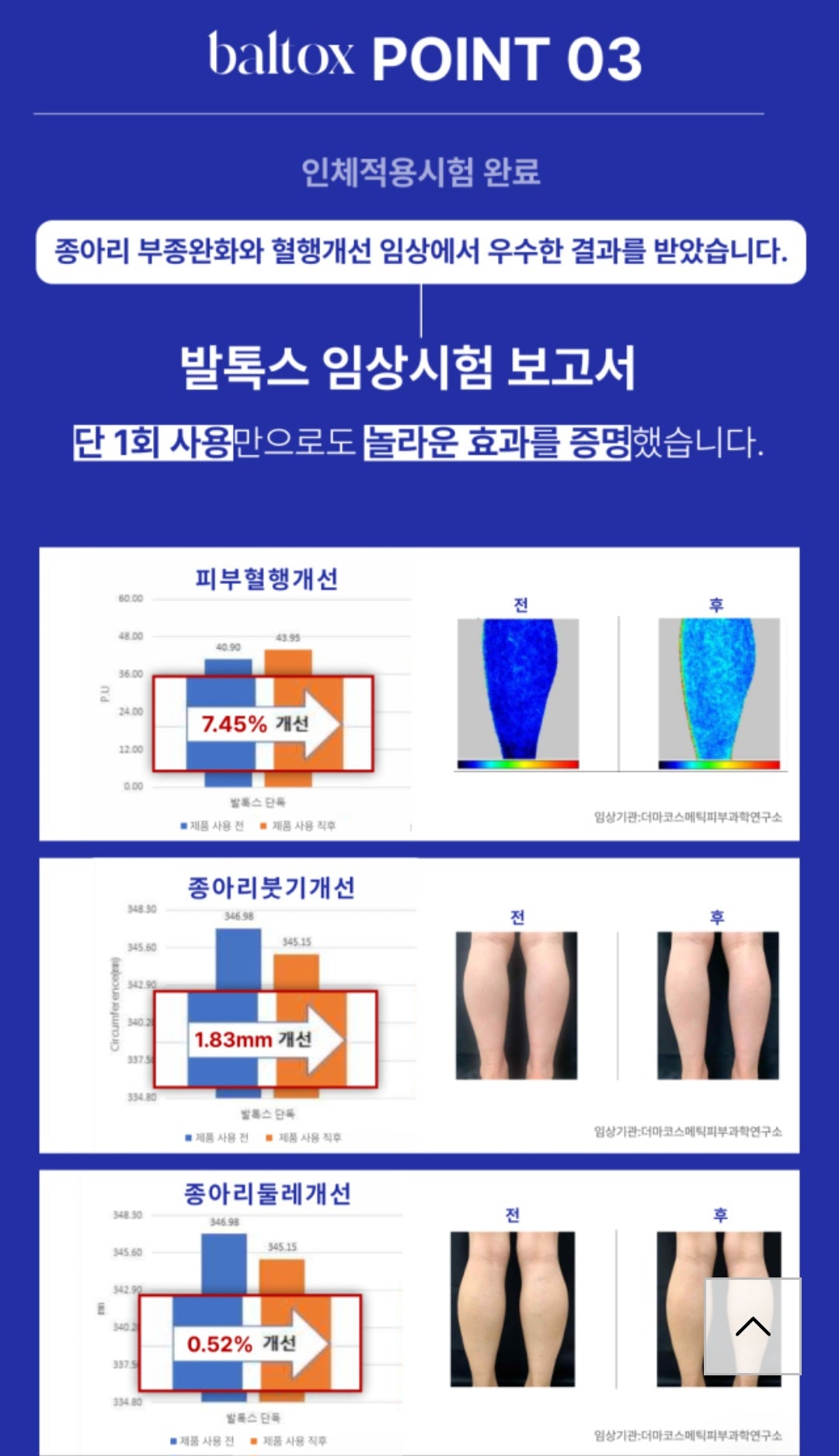⏩️ 발톡스 EMS 발마사지 & 마이너스 크림