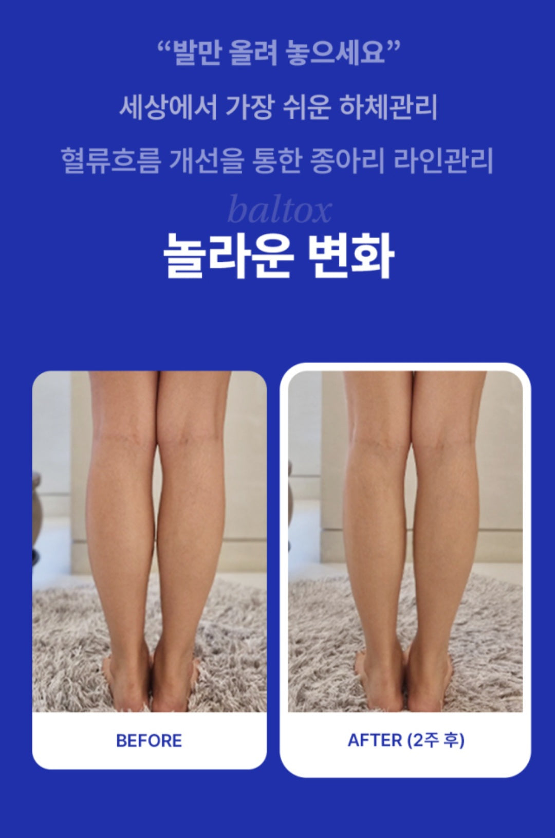 ⏩️ 발톡스 EMS 발마사지 & 마이너스 크림